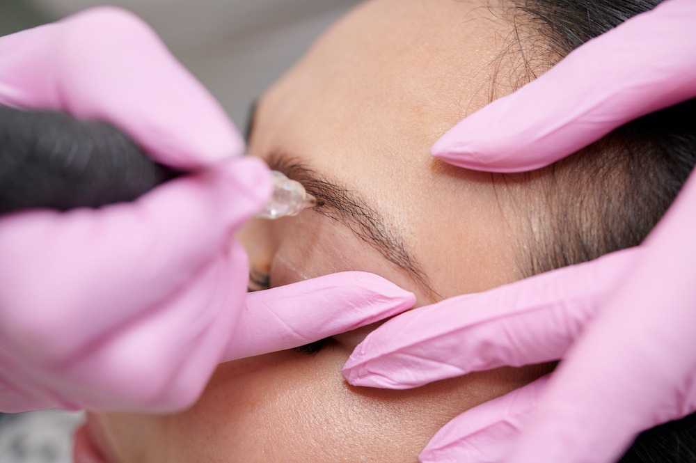 young woman receiving microblading treatment
