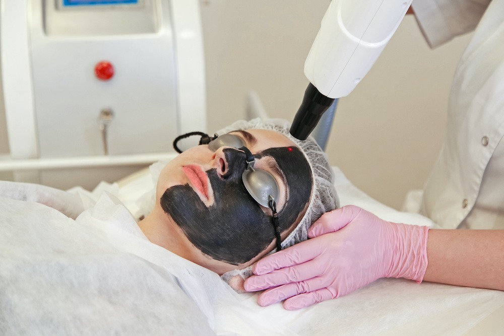 young woman receiving picolazer treatment